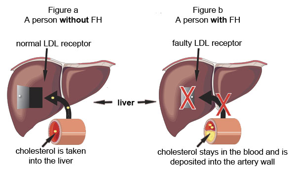 Liver1